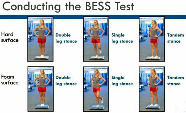 The BESS Test for balance assessment