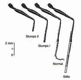 Figure 9: Stumps and Stilts