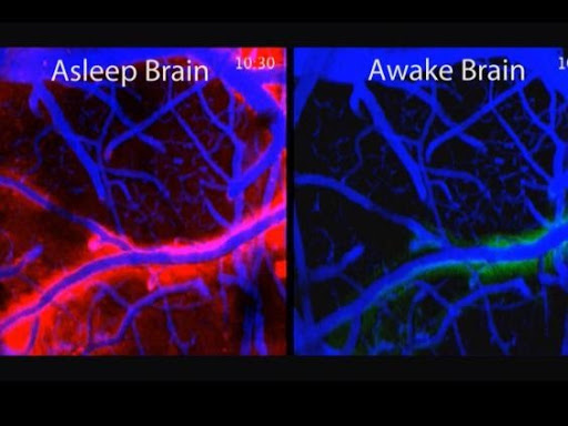 Brain sleeping and awake from 'Sailor's Sleep' article by Dr Michael Cohen.